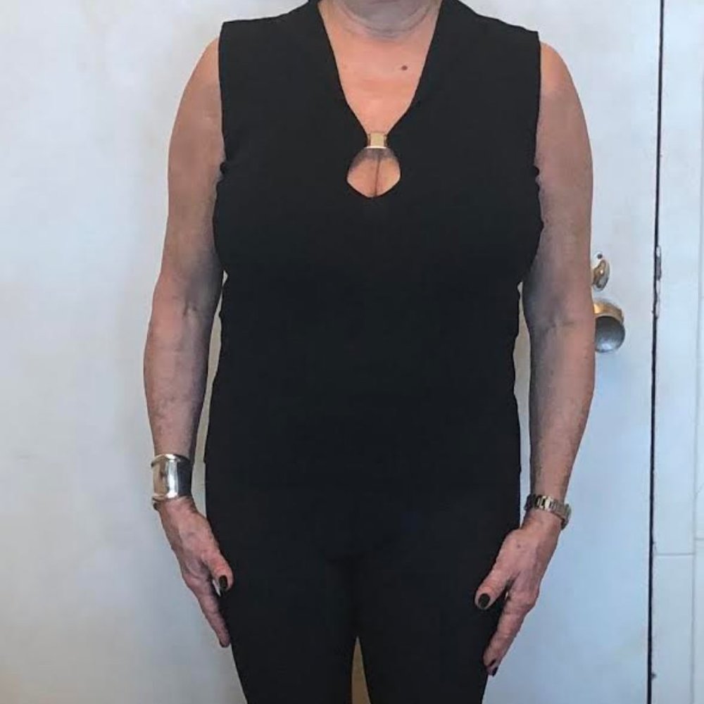 Sleeveless Forgiving Body-conscious Top